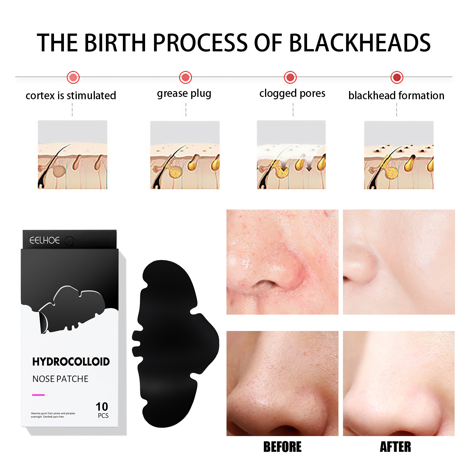 Hydrocolloid Nose Patch- Beauty And Sales
