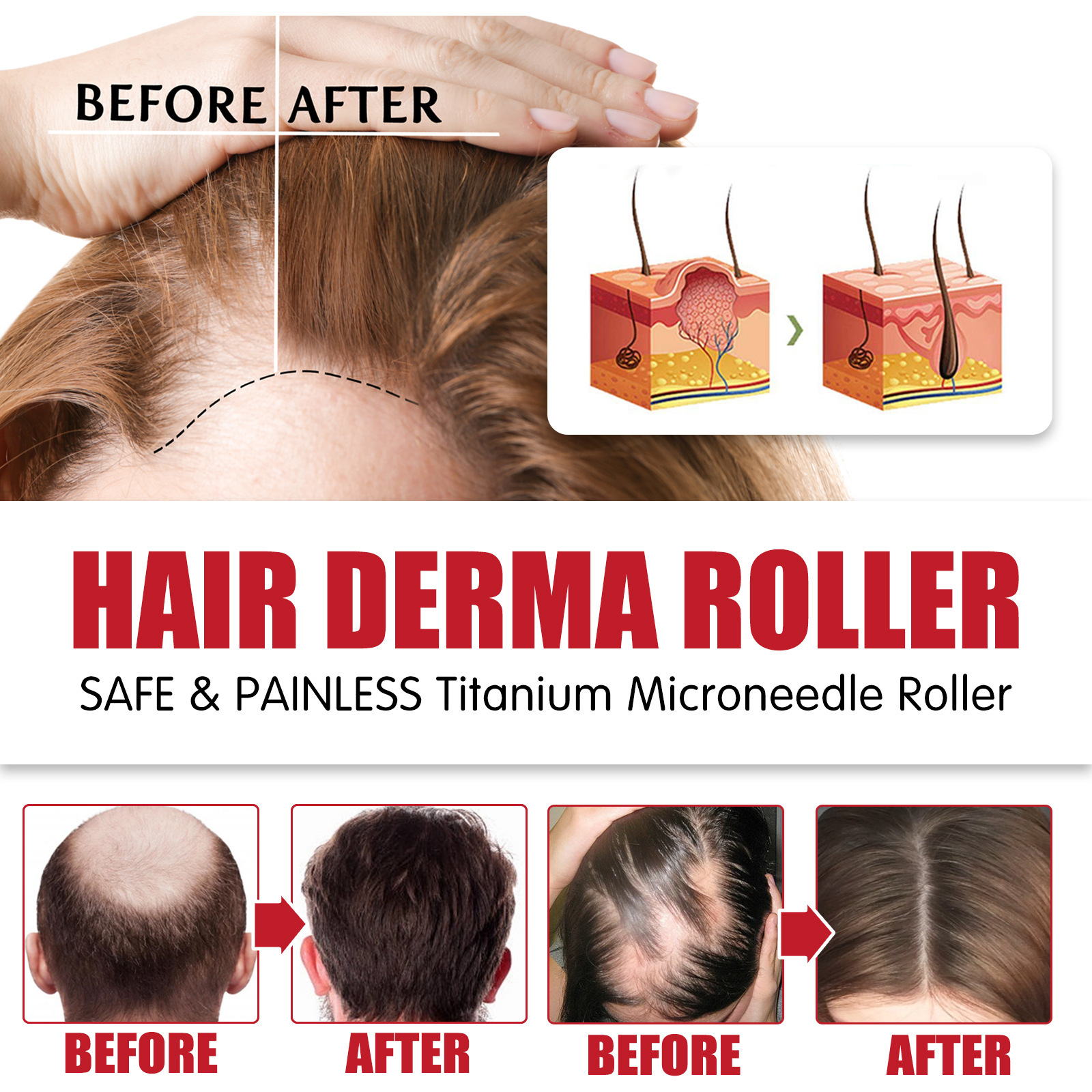 Hair Roller - Absorption Soins